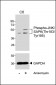 Phospho-JNK/SAPK(Thr183/Tyr185)