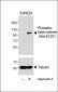 Phospho-beta-catenin (Ser33/37) Antibody
