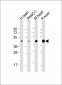 WNT5A Antibody (Center)