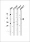 WNT5A Antibody (Center)