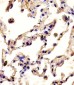 MMP12 Antibody (C-term)