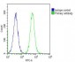 CBS Antibody (Center)