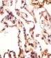 AOC3 Antibody (Center)