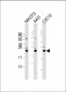 RAB7 Antibody (C-term)