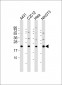 RAB7 Antibody (C-term)