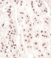 CDC73 Antibody (Center)