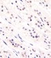 CDC73 Antibody (Center)
