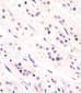 CDC73 Antibody (Center)