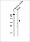 ANGPTL4 Antibody (Center)