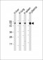 PLA2G7 Antibody (Center)