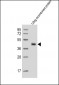 GST Tag Antibody