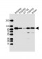ACO1 Antibody (N-Term)