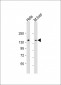 LMTK3 Antibody (N-term)