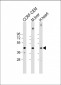 NKX2-5 Antibody (Center)