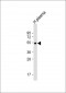 GC Antibody (N-Term)