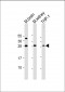 TPD52 Antibody (N-Term)