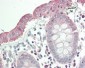 Anti-CO-029 / TSPAN8 Antibody (aa110-160) 