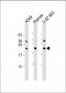 CD81 Antibody