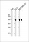 MMP1 Antibody