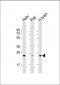 RAB14 Antibody