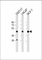 PRMT6 Antibody (N-term)