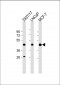 PRMT6 Antibody (N-term)