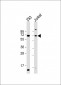 CYP2B6 Antibody (Center)