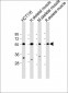 TRIM72  Antibody (C-term)