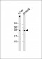 LIN28B Antibody (N-term)