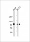 HUMAN-CTNND1_isform 2ABC(Y174) Antibody
