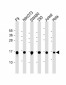 UBE2D2 Antibody (N-term)