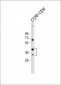 Mouse Nkx2-5 Antibody (Center)