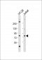 ACSS1 Antibody (N-Term)