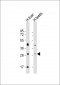 SRD5A1 Antibody (Center)