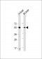 UGT1A9 Antibody (N-Term)