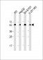 PEPD Antibody (C-Term)