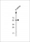 UGT1A9 Antibody (C-Term)