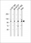 SH3PXD2B Antibody (Center)