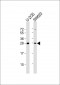 TK1 Antibody (Center)