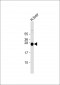 GSTA5 Antibody (N-Term)