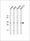 RPS2 Antibody (C-Term)