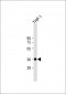 IKB alpha (IKBA) Antibody