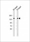 HIPK3 Antibody (C-term)