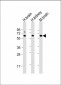 GLS Antibody (C-term)