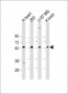 ENTPD2 Antibody (N-term)