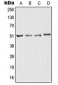 Anti-NOGO-A / RTN4R Antibody (Internal) 