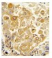 TLR2 Polyclonal Antibody 