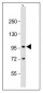 TLR2 Polyclonal Antibody 