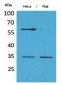 CD32 Polyclonal Antibody