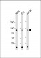 HK2 (Hexokinase II) Antibody
